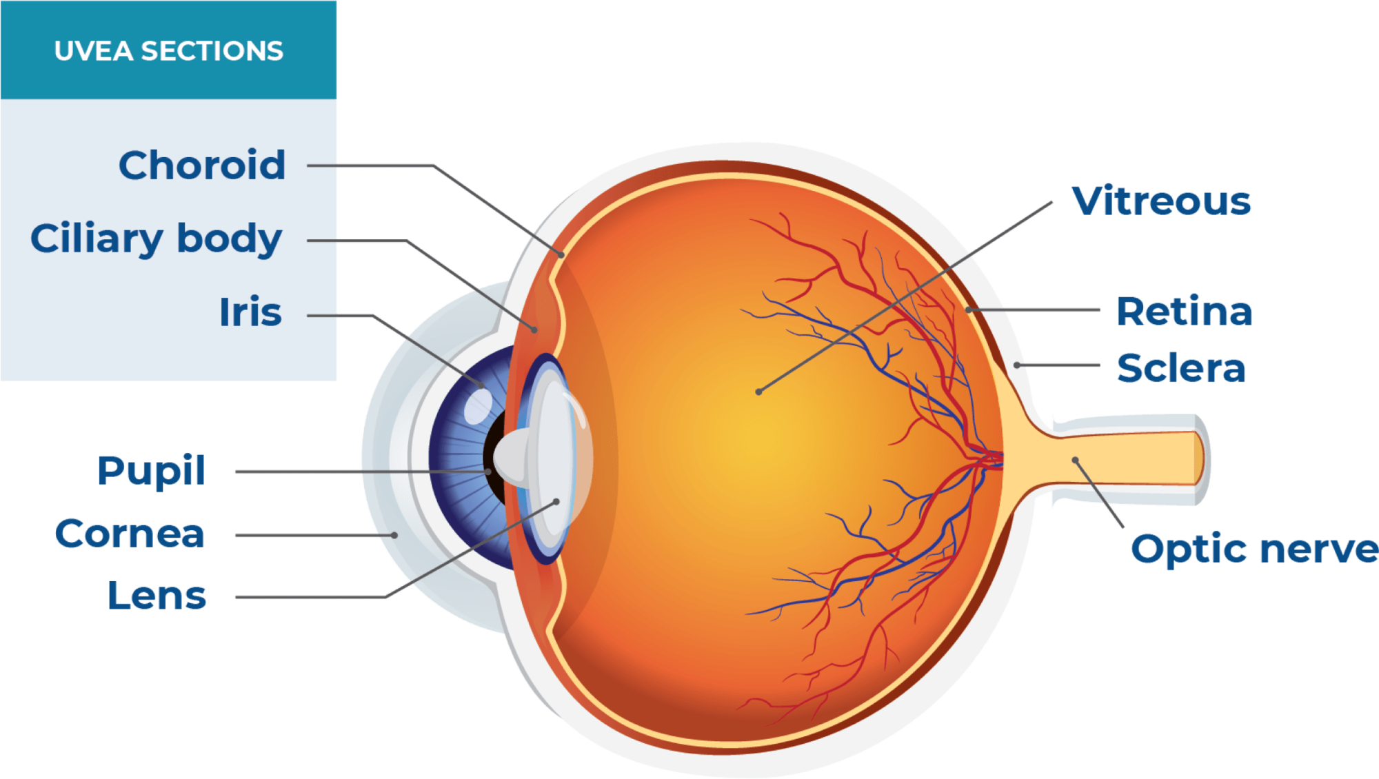 Uveal Melanoma 