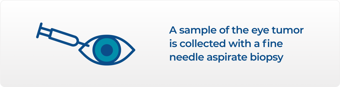 A sample from an eye is collected with a fine needle aspirate biopsy