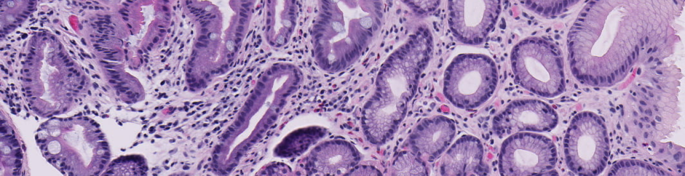 A purple stained microscopic image of cells